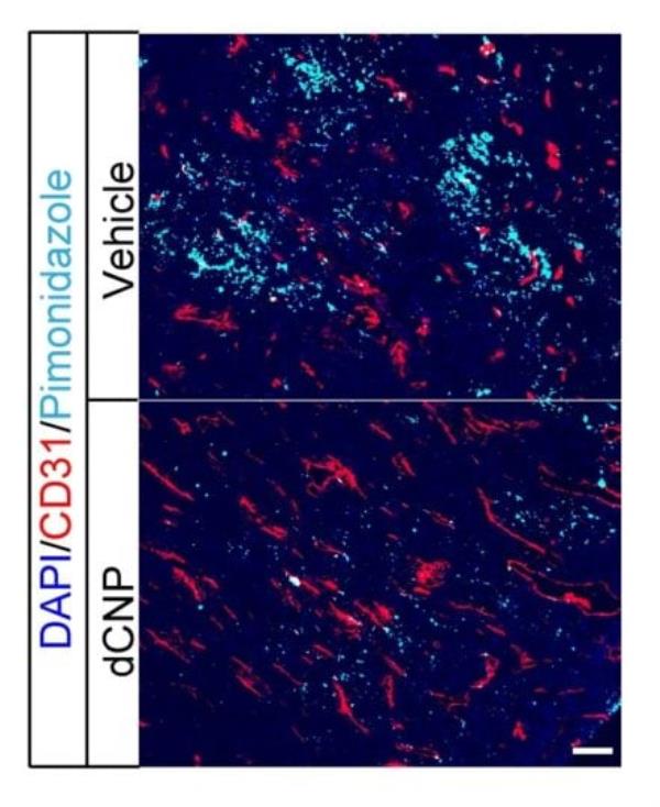 Pimo<em></em>nidazole is a marker of hypoxia, or low levels of oxygen at the tissue level, and CD31 can be used to measure blood vessel density. This image of hypoxic cells and endothelial cells within co<em></em>lon tumors therefore shows how the dCNP treatment decreases hypoxia and increases blood vessels.